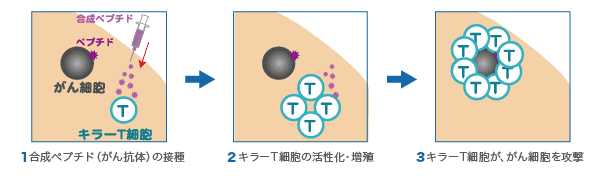 キラーT細胞